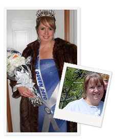 Kelly T.'s Before and After Photo after having successful lap band surgery