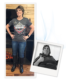 Janice F.'s Before and After Photo after having successful gastric sleeve surgery